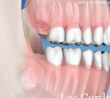 CORDALES-DIVINASONRISA-670x446