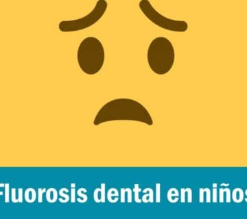 FLUOROSIS-I-670x446-divina-sonrisa