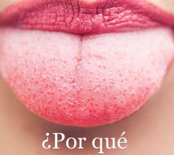 POST-11-670x446-divina-sonrisa