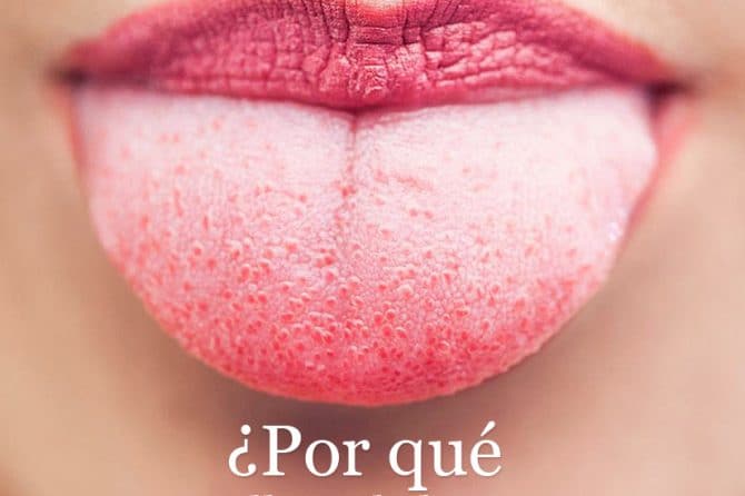 POST-11-670x446-divina-sonrisa