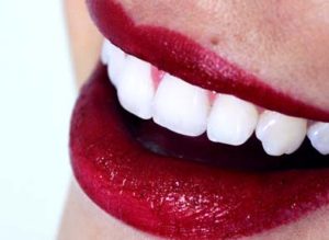 estetica-dental-divina-sonrisa