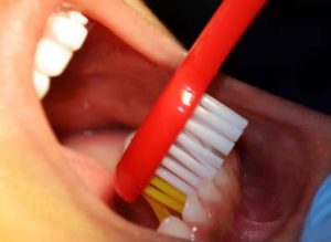 odontopediatria-divina-sonrisa