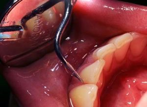 periodoncia-dental-divina-sonrisa